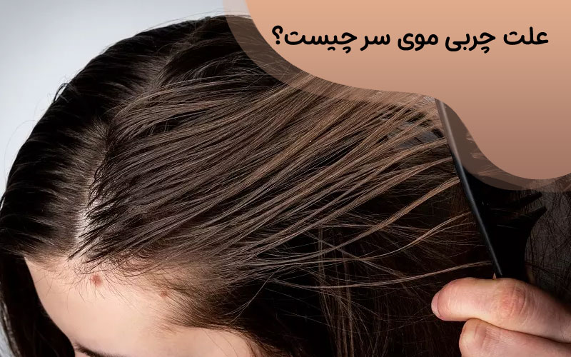 علت چربی موی سر چیست